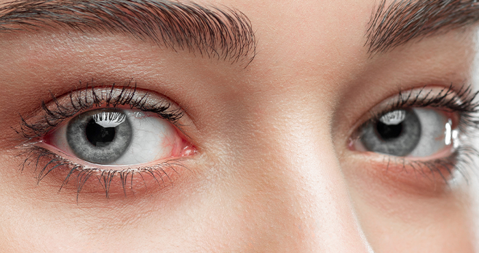 ARTELAC® BiCare